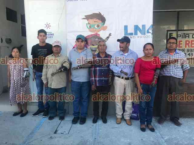 Donan prï¿½tesis de manos a 13 personas en norte del Estado