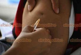 Xalapa, Ver., 22 de septiembre de 2026.- Xalapeños acuden a aplicarse la vacuna contra el sarampión.
